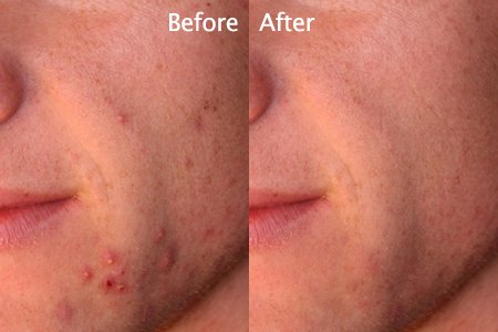 How to Fix Spots with Blemish Removal Tool