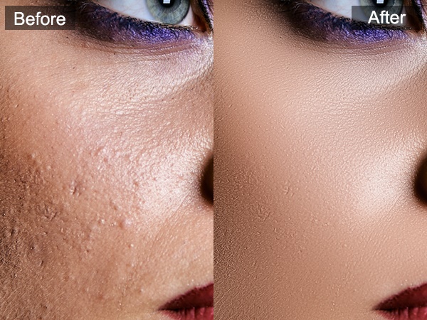 SkinFiner Effect Compare
